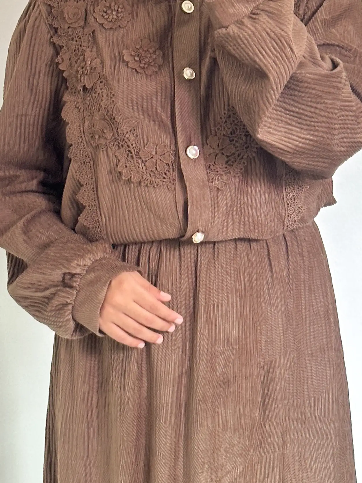 Grace Lace Skirt Set - Image 2